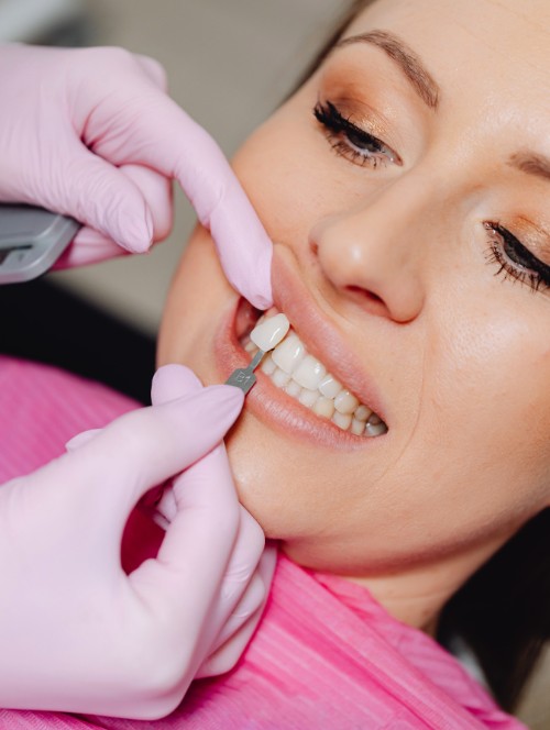 Veneers and Laminates Goregaon